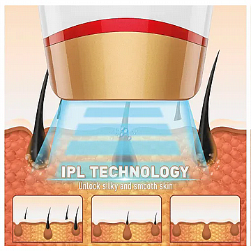 מכשיר ביתי להסרת שיער IPL דגם: MC-1280